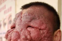 Hoảng hồn những “mặt nạ” trên cơ thể người 