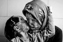 Bộ ảnh mẹ con bị tạt a xít gây rúng động