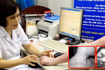 Mặt biến dạng vì kem rởm