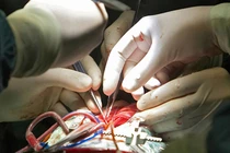 “Nuôi” nội tạng người trên cơ thể động vật