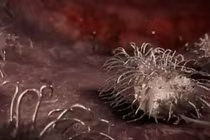 Cận cảnh vi khuẩn “làm thịt” cơ thể người