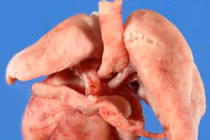 10 triệu chứng y tế kỳ lạ nhất thế giới