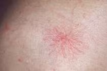 Những biểu hiện trên cơ thể báo hiệu bệnh tật