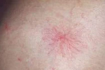 Những biểu hiện trên cơ thể báo hiệu bệnh tật