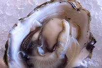 Điểm lại những sự kiện y tế - sức khỏe nổi bật tuần qua