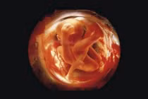 Chuỗi hình tuyệt đẹp về sự hình thành thai nhi