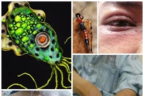 Những loài động vật, ký sinh trùng gây bệnh nguy hiểm nhất năm 2012