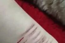 Kinh hãi clip thiếu nữ dùng dao lam tự rạch tay