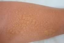 Kem tắm trắng siêu tốc là thuốc... tẩy tóc?