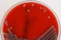 Chi tiết vi khuẩn ăn thịt người ‘ngấu nghiến’ tế bào