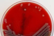 Chi tiết vi khuẩn ăn thịt người ‘ngấu nghiến’ tế bào