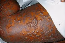 Hình ảnh khủng khiếp sau khi dùng thực phẩm chức năng