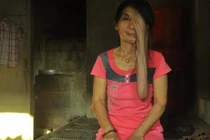 Người đàn bà 50 năm cô đơn cùng “gương mặt quỷ“