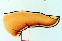 Đoán tài năng qua ngón tay cái 