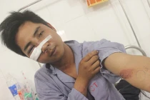 141 Hà Nội bị “tố” đánh gẫy xương gò má người dân