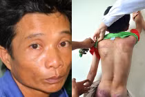 Cha bạo hành con 9 tuổi gây chấn động ở Quảng Ngãi