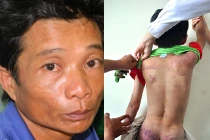 Cha bạo hành con 9 tuổi gây chấn động ở Quảng Ngãi