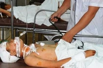 Nổ đạn kinh hoàng, 8 học sinh thương vong