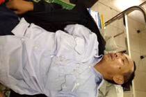 Lái xe buýt nhập viện vì bị đánh toác đầu