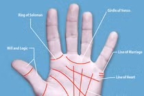 Rộ mốt phẫu thuật chỉ tay đổi mệnh