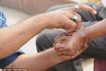 Hãi hùng cảnh chích máu chữa bệnh bằng dao lam