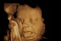 Chùm ảnh: Biểu cảm đáng yêu của bé trong bụng mẹ