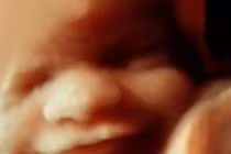 Hình ảnh 3D đáng yêu về thai nhi cười trong bụng mẹ