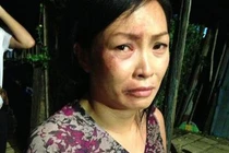 Phương Thanh sưng tím mặt mày vì bị đánh