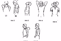 Bài tập giảm đau thoái hóa đốt sống cổ 