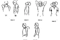Bài tập giảm đau thoái hóa đốt sống cổ 