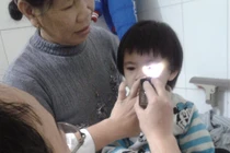 Bé bỏng mắt vì nghịch gói hút ẩm