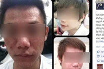 Chàng trai Sài Gòn tung ảnh “thảm họa” vì tiêm trắng da