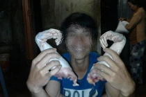 Phẫn nộ nam thanh niên chụp hình cùng 2 bàn tay khỉ