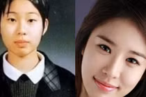 Sao Hàn xấu xí thời chưa “dao kéo“
