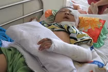 Hai cháu bé ngã từ mái nhà, một tử vong