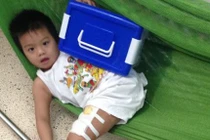 Cháu bé bị cắt chân vẫn chưa biết mất cha mẹ