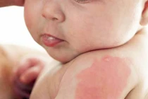 Giải mã hiện tượng sinh con khó nuôi