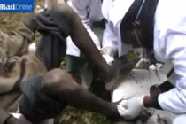 Hàng trăm con bọ chét làm ổ dưới chân người