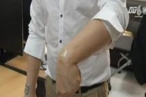 Da nhân tạo kỳ diệu thế nào?