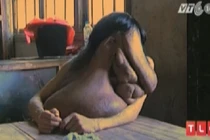 Kỳ lạ người đàn ông mặt voi