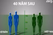 Làm gì để người Việt không lùn nhất châu Á?