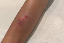 Bị phạt quá ký, khách bay cắn nhân viên hàng không tại Tân Sơn Nhất