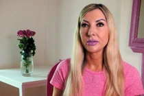 Chi cả tỉ bạc phẫu thuật thẩm mỹ và cái kết đau lòng