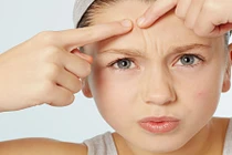 Không muốn mặt bung bét, đừng làm điều này khi bị mụn 