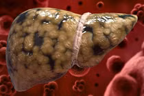 Những thần dược rẻ tiền giúp gan khoẻ như vâm