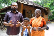 Hứng chịu “lời nguyền”, đại gia đình Ấn Độ sinh ra với bàn tay nhện