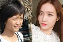 Soi nhan sắc trước và sau thẩm mỹ của thí sinh The Face 2017