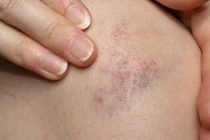 Dấu hiệu không thể bỏ qua nhận biết căn bệnh khiến Hạnh An qua đời ở tuổi 20