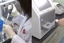 Phát hiện 13 loại ung thư chỉ với một giọt máu