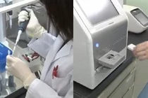 Phát hiện 13 loại ung thư chỉ với một giọt máu